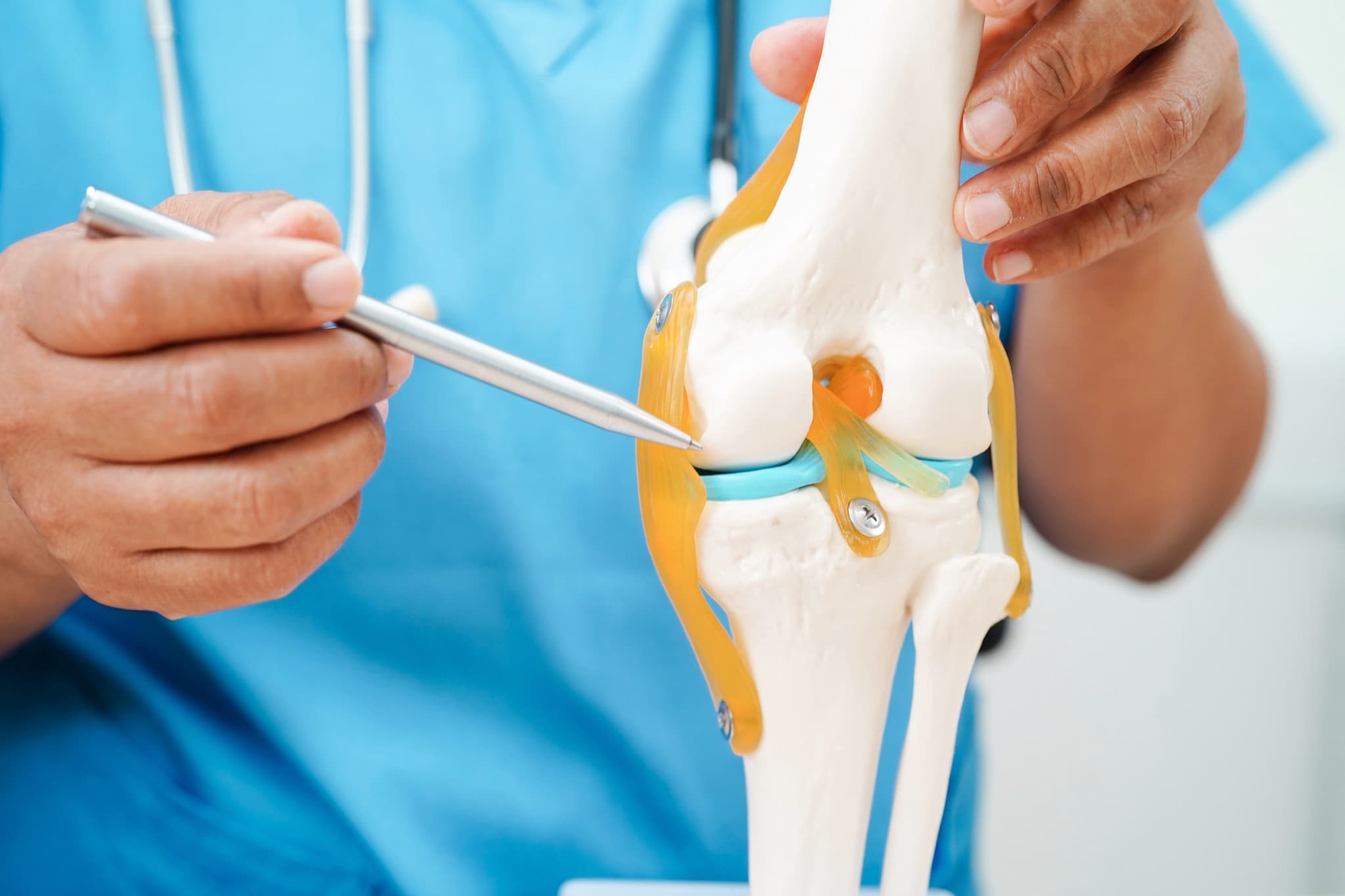 Doctor demonstrating a knee joint model during joint replacement consultation